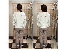 コアスタイル(Core×Style)/【姿勢矯正】Before → After