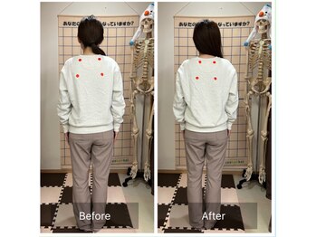 コアスタイル(Core×Style)/【姿勢矯正】Before → After