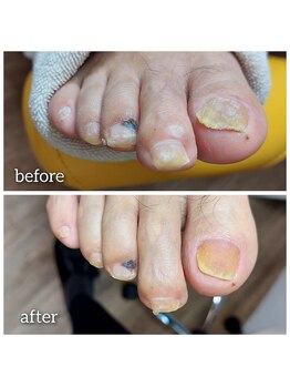 爪切り屋 足楽/