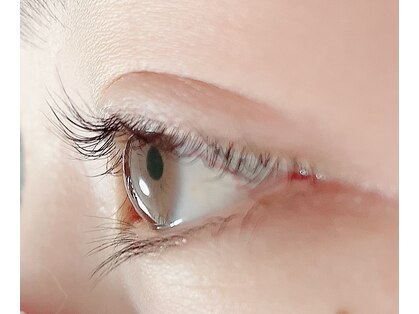 レスト(Rest)の写真