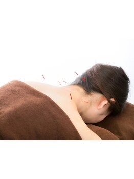 眼精疲労を解消したい