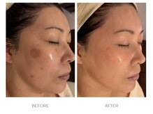 ボンクール(BONCOEUR)