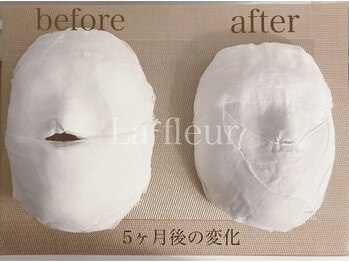 ラ フルール(La Fleur)/コルギ石膏パックbefore→after