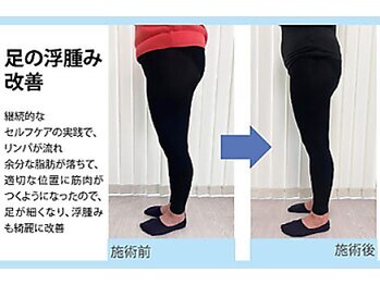 セルフケア整体 新宿店/足のむくみ改善/骨盤矯正/リンパ