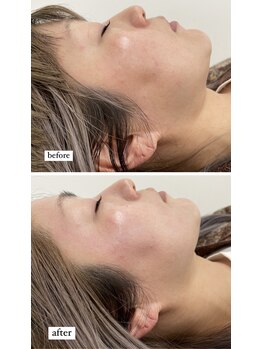 アイラッシュ バイ ポジャ(EYELASH by Poja)/クリスタルパック