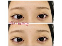ネオビューティー(Neo beauty)/２４時間ぱっちり目で＾Ｏ＾☆♪