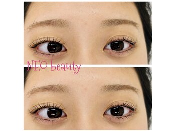 ネオビューティー(Neo beauty)/24時間ぱっちり目で^O^☆♪