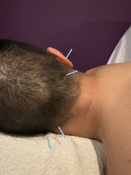 アディクト(Addict)/首の凝りにも◎