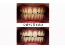 エム(M)/６回変化写真