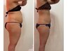 本気痩せ!デトックス痩身90分/1ヶ月通い放題