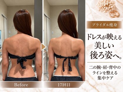 ラブミー 渋谷本店(LoveMe)の写真