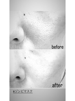 エムイーボーテ(me.Beaute)/【ゾンビマスク 】40代　1回目