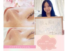 ディディモア サロン(DDmore Salon)の雰囲気（その時のお肌状態・肌悩みにアプローチし、ベストな施術を選択）