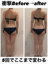 美容整骨小顔ラボ/ハイパーナイフ×全身矯正