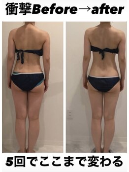 美容整骨小顔ラボ/ハイパーナイフ×全身矯正