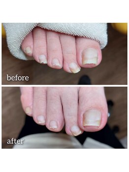 爪切り屋 足楽/