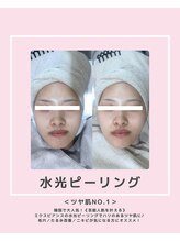 ソワナ(soina)/【神楽坂駅/フェイシャル/毛穴】