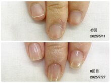 キアラネイル(Chiala nail)/自爪育成