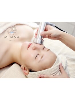 小顔になりたい