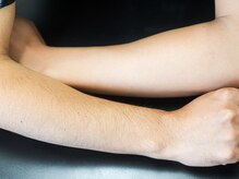 エリクサー 熊谷店(Elixir)/産毛も効果あり！