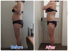 鈴木整体院 仙台長町院/小顔造顔/骨盤矯正/痩身整体