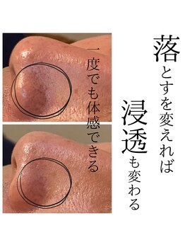 ドルミール(Dormir)/ハイドラフェイシャル◆毛穴洗浄