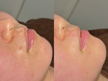 ルーナジェーナ(Luna llena)/池袋 エステ ルーナジェーナ