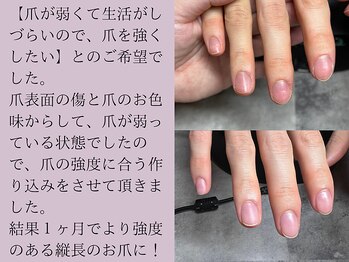 サロンエヌ(salon enu)/パラジェル深爪緩和クリアコース