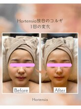 オルテンシア(Hortensia)/コルギ☆ビフォーアフター