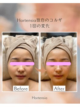 オルテンシア(Hortensia)/コルギ☆ビフォーアフター