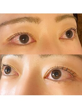 ブルームエイト(Bloom8)/