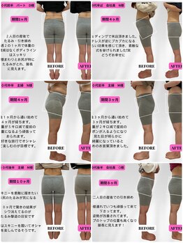 ビジリンヌ/ダイエット広島市