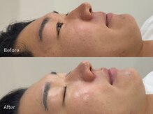 アウラ 小杉店(AULA)/ララピール☆