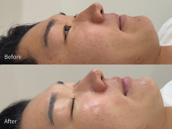 アウラ 小杉店(AULA)/ララピール☆