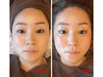 アイリス(AIRIS)/くすみにお悩みの方