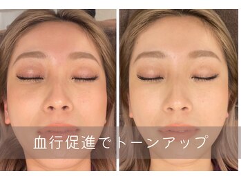 叶'エル 本町 心斎橋院/小顔矯正