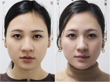 さつま骨格矯正 表参道青山院/歪み小顔矯正＋骨盤矯正