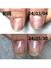 ココ(COCO)/ピンク部分が伸びてきました