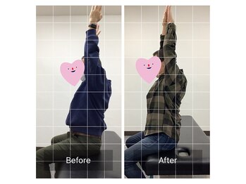 ナオル整体 勝田台院(NAORU整体)/勝田台・矯正・整体・肩の痛み