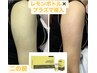 二の腕すっきりレモンボトル、プラズマ×リンパ集中ケア