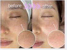 マルサンカクシカク(○△□)