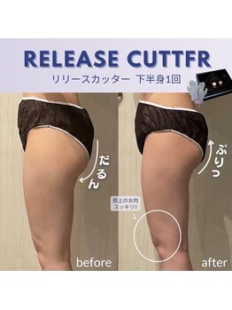 フルアナ(Hu ruana)/痩身/ダイエット/筋膜リリース