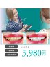 まずはコレ!セルフホワイトニング【5分×2回￥3980】