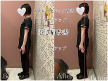 ユルル 刈谷店(Yururu)/ビフォーアフター(猫背整体)
