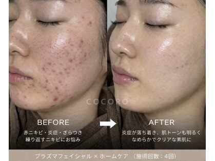 ココロ(COCORO)の写真