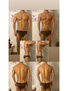 京橋メンズビューティーラボ(KMB LAB.)/ハイパーナイフのbefore/after