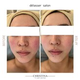 デラッセ(Delasser salon)