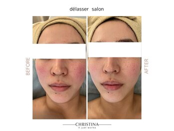 デラッセ(Delasser salon)