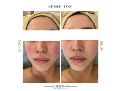 デラッセ(Delasser salon)の写真