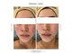 デラッセ(Delasser salon)の写真